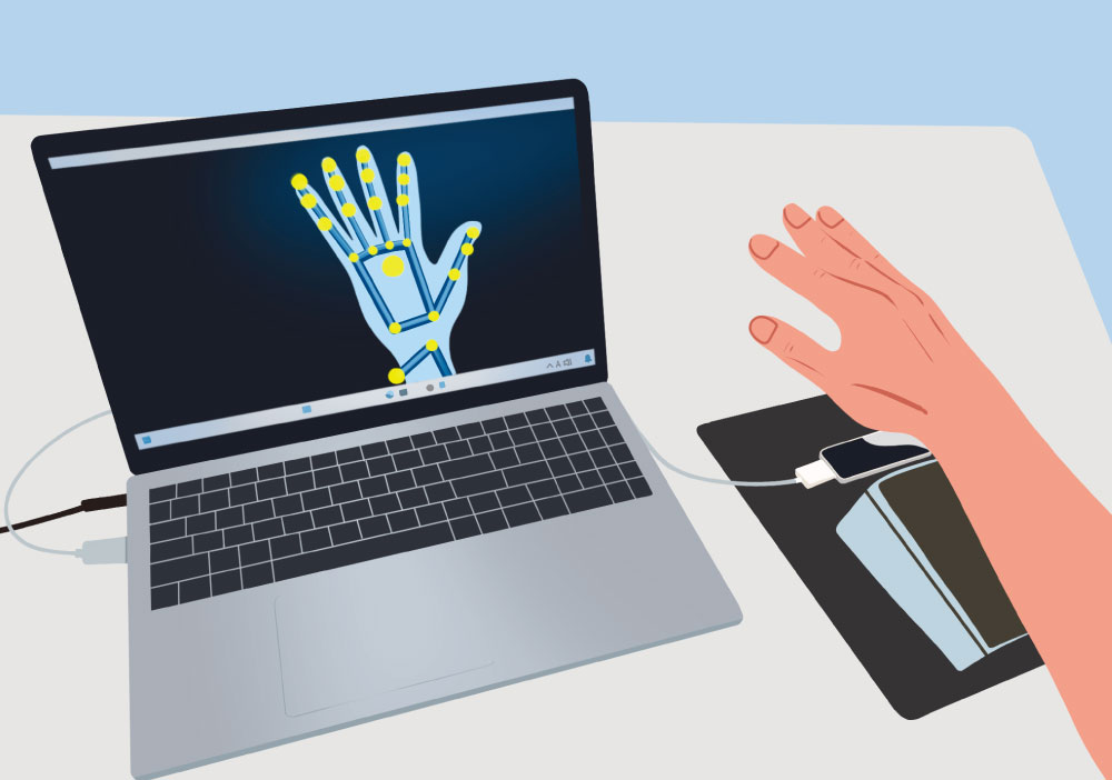 赤外線カメラを用いた麻痺手動作の解析