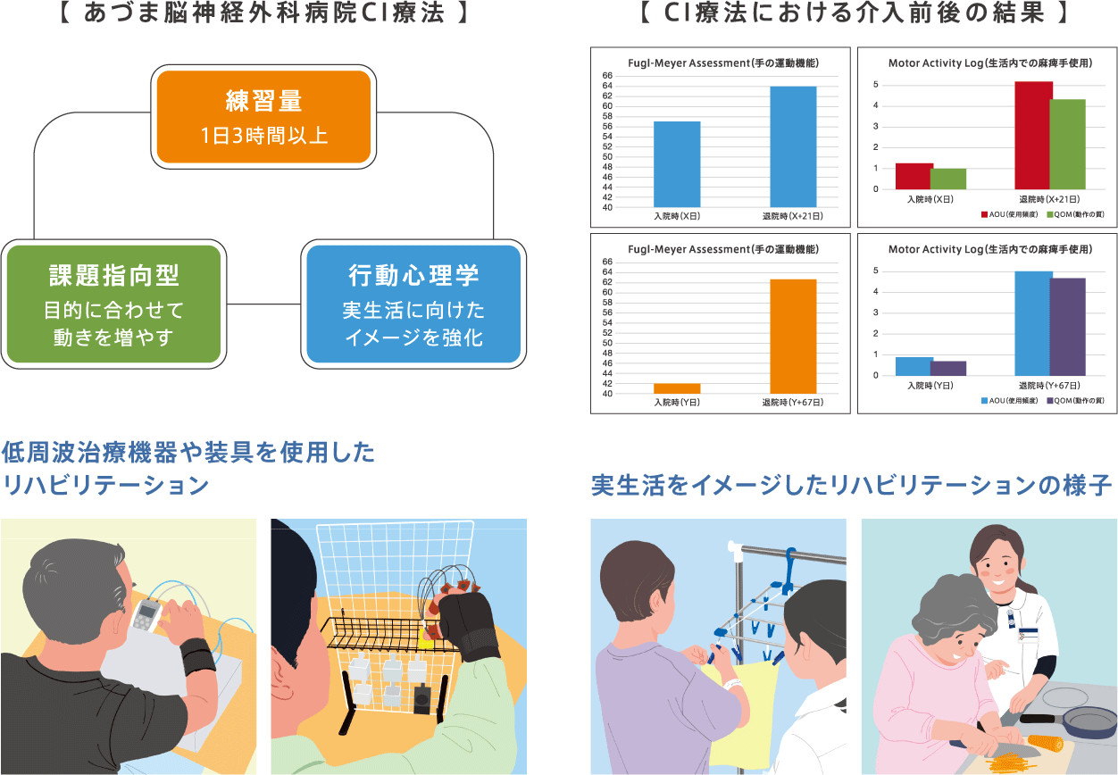 あづま脳神経外科病院CI療法、CI療法における介入前後の結果、低周波治療機器や装具を使用したリハビリテーション、実生活をイメージしたリハビリテーションの様子